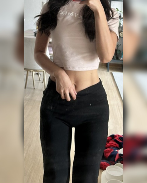 후이미지