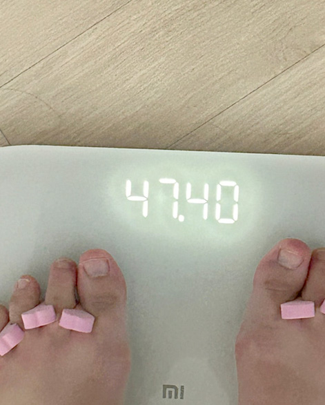 후이미지